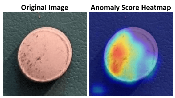 Detect Image Anomalies Using Explainable One-Class Classification Neural Network