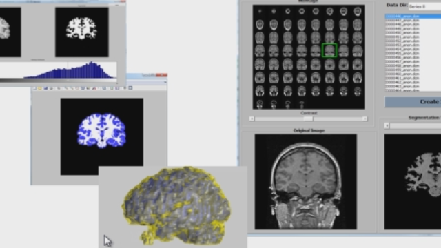 从DICOM文件中加载一个MRI图像堆栈，使用分割和形态学来识别脑组织，并创建一个体积可视化。