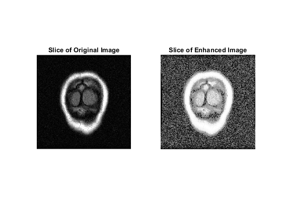 图中包含2个轴。原始图像切片包含一个类型为Image的对象。带有标题的轴2增强图像切片包含一个类型为Image的对象。